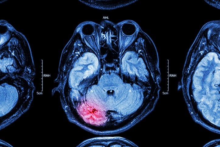 Sport-Related Concussions: Modern Athlete Care, , large image number 1
